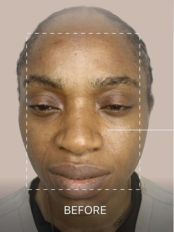 Before skincare treatment or procedure image.