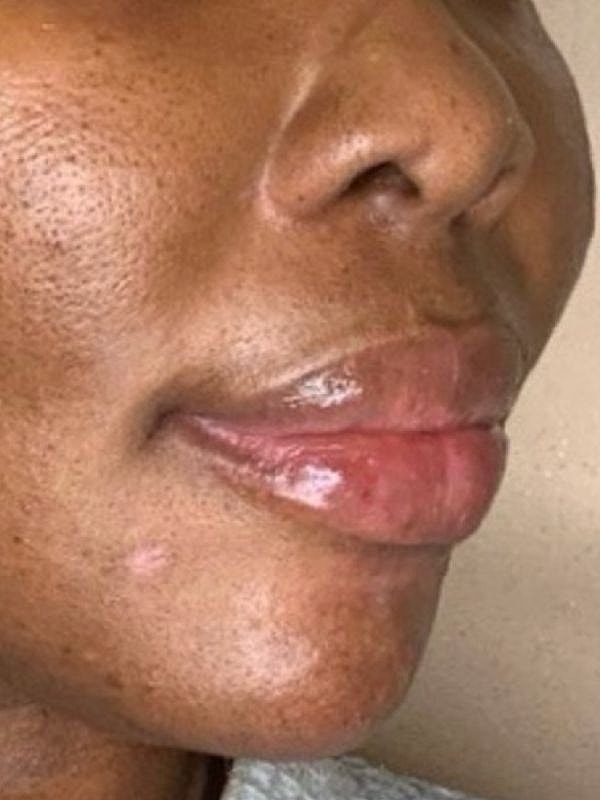 Close-up of a woman's lips and skin.