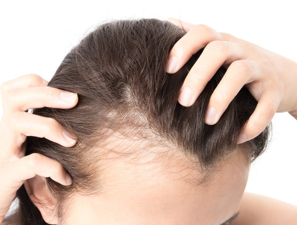 PRP Injections for Hair Loss