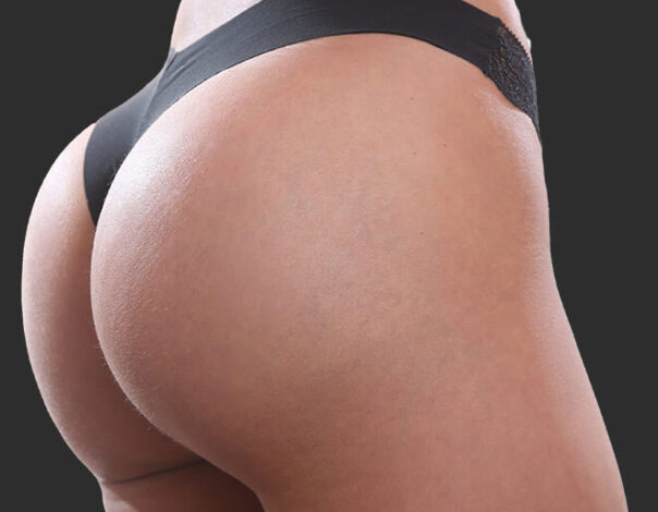 Enhance Your Butt With a Non Surgical Butt Lift